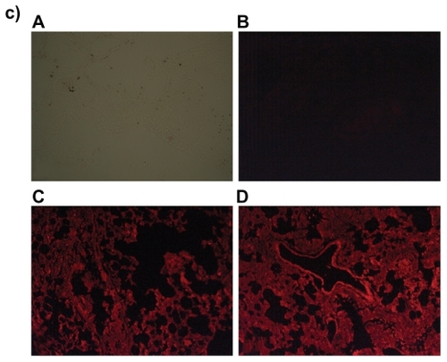 Figure 8 Fluorescence microscopic photographs of liver a), kidneys b) and lungs c); of rats treated with phosphatidylethanolamine-doxorubicin (PE-DOX) liposomes (A = negative control; B = positive control; C = one hour after treatment; D = three hours after treatment).