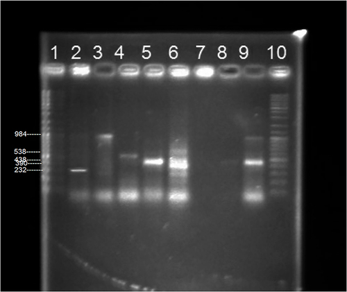 Figure 3 Multiplex PCR results showing the detection of carbapenemase genes (Lane 1, Lane 10 molecular ladder; Lane 2, 3, 4, 5, 6 correspond to blaIMP, blaNDM, blaKPC, bla OXA-48, bla VIM; Lane 7 negative control of amplification; Lane 8 negative sample; Lane 9 showing bla NDM and bla OXA-48).