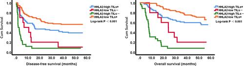 Figure 5 Kaplan-Meier survival curves showing DFS and OS of patients with HCC according tumor microenvironment based on HHLA2 expression and density of TILs. Patients with type I HCC (HHLA2 - high TILs +) or type IV HCC (HHLA2 - low TILs +) showed significantly better DFS and OS.