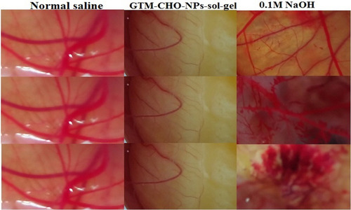Figure 12 Comparative HET CAM image of optimized gentamycin chitosan nanoparticles sol-gel (GTM-CHNPopt sol-gel, NSG5), 1 M NaOH (positive control) and normal saline (control)-treated egg.