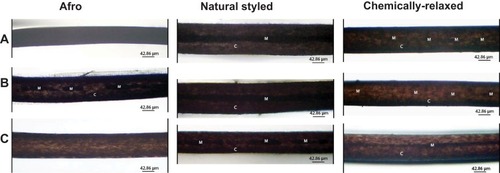 Figure 3 (A-C): Micrographs showing the cortex and medulla of hair from different parts of hair strands from various hairstyle groups. (A) shows the cortex (C) and medulla (M) of proximal hair, whereas (B) and (C) show strands from middle and distal parts, respectively.