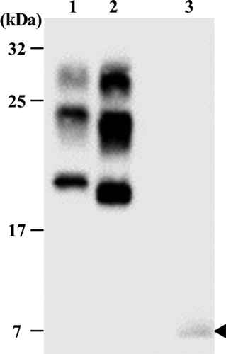 Figure 1. Western blots analysis of the brain homogenates of the patient, after proteinase K treatment. Brain homogenates from one patient with sporadic Creutzfeldt-Jakob (CJD) with methionine homozygosity type 1 (lane1), one patient with sporadic CJD with methionine homozygosity type 2 (lane2), and our patient (lane3) were treated with proteinase K and underwent sodium dodecyl sulfate-polyacrylamide gel electrophoresis. A low molecular weight band at approximately 7 kDa was detected without a high molecular weight band in our patient (arrow head).