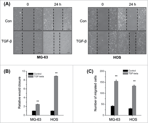 Figure 1. TGF-β triggers the in vitro motility of osteosarcoma cells. (A) MG-63 and HOS cells were treated with or without TGF-β (20 ng/ml) and then scraped by a pipette tip to generate wounds for 48 h, representative images of wounds were observed; (B) The statistic results of wound healing assays; (C) MG-63 and HOS cells treated with or without TGF-β (20 ng/ml) were allowed to invade transwell chambers for 48 h, then the invaded cells were fixed, stained, and counted. Data are presented as means ± SD of 3 independent experiments. **p < 0.01 compared with control.