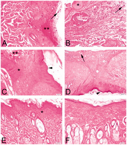 Figure 1. Representative skin wound sections from both experimental groups on days 3 (A, B), 7 (C, D) and 14 (E, F). Large amount of inflammatory infiltrate consisting predominantly of neutrophils (arrows) in control (A) and treated (B) groups on day 3. Marked accumulation of exudate (*) and hemorrhage (**) can be observed. Diffuse granulation tissue (*) and completely disrupted areas in the dermis (**) in the controls (C) and dilated neovessels (arrow) in the treated group (D) are observed at day 7. Epithelial regeneration (arrowheads) is apparent. Almost complete epithelization of wound sites on day 14 are observed. Ongoing granulation tissue in the subepidermal region (*) is noted in the controls (E) compared to almost totally healed wound site in the treated rats (F). Hematoxylin and Eosin (H&E) stain, Bars: 20 μm (A, B); 100 μm (C, D); 50 μm (E, F).