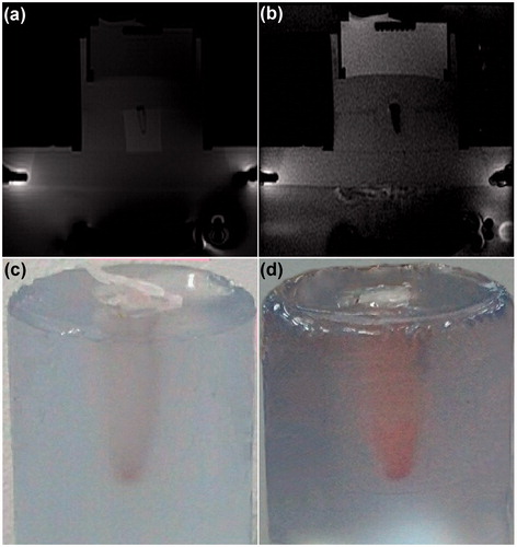 Figure 9. Influence of MRgFUS sonication on drug-loaded nanoparticles. (a, b) Magnetic resonance phase images of a typical thermosensitive phantom containing drug-loaded PMSNs before and after MRgFUS treatment, respectively. (c, d) The colour change of the aqueous solution containing drug-loaded PMSNs after MRgFUS treatment, confirming the partial release of encapsulated drug.