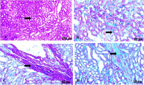 Figure 7. (A–D) Light photomicrograph of sections from maternal kidney of control (A) and GAE received group (B–D) stained with Masson’s Trichrome: light photomicrograph of (A) shows normal of fibrous tissues. Photomicrograph of (B–D) shows potent infiltration of fibrous tissues with darkish blue coloration.