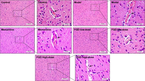 Figure 8 Effect of Fuzheng Quxie Decoction (FQD) on cerebrovascular morphology in the cortex of SAMP8 mice.