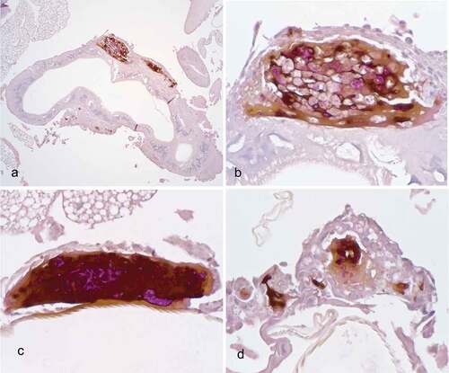 Figure 8. Histopathology of G. mellonella infected with P. destructans and kept at 15°C. A. Granuloma-like hemocyte nodules (arrow heads) with prominent melanin deposition expanding in the wall of organelle (Org) (10x; scale 100 µm). B. Higher magnification of melanized granuloma-like nodule, note numerous PAS-positive fungal elements admixed with hemocytes (*). C-D. Granuloma-like nodule with prominent PAS-positive fungal elements and marked melanin deposition on the wall of organelles (arrow heads). (50x; scale 10 µm).