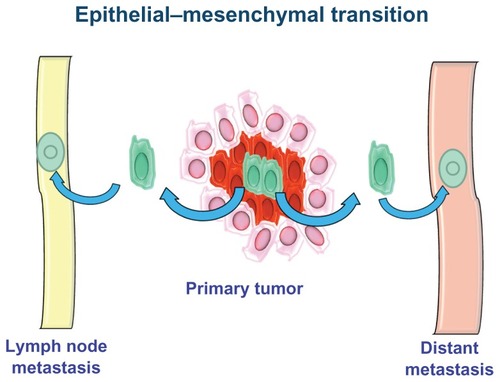 Figure 3 Epithelial–mesenchymal transition.