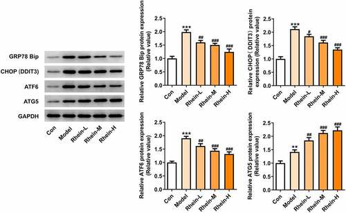 Figure 13. Rhein treatment affected ERs and autophagy of 3T3-L1 cells with inflammatory stimulation. Representative images and quantification of ERs-related proteins and autophagy-related protein in 3T3-L1 cells with inflammatory supernatant induction. The supernatant culturing Raw246.7 cells with LPS stimulation was collected and used to incubate with 3T3-L1 preadipocytes. Each experiment was repeated at least three times. ***p < 0.001 versus control. #p < 0.05, ##p < 0.01, ###p < 0.001 versus Model