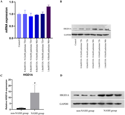 Figure 3. HIGD1A expression is elevated under high-fat exposure. qRT-PCR (A) revealed that HIGD1A expression was not increased when HepG2.2.15 cells were exposure to different concentration of OA and palmitate, however, western blot (B) revealed that HIGD1A expression was increased significantly upon exposure to 0.8 mM OA and 0.4 mM palmitate for 96 h in HepG2.2.15 cells. Meanwhile, qRT-PCR (C) and western blot (D) also shown that HIGD1A expression in liver tissue was higher significantly in NASH group than non-NASH group of mice (# p < 0.05 compared with non-NASH group).