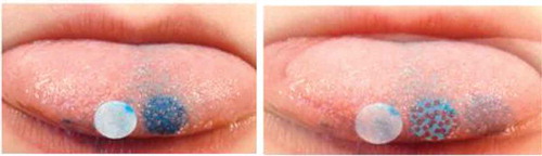 Figure 1. Photos of the stained tongue with and without papillae counted.