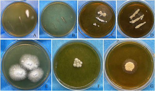 Figure 3 The culture results of patients with tinea capitis. (A and B) the image for direct culture of colonies on Sabouraud’ s Dextrose agar (SDA) after sampling from the scales on the top of the head and occipital, respectively. (C and D) the image for direct culture of colonies on Modified Dixon agar after sampling from the scales on the top of the head and occipital, respectively. (E) a representative image for purification of colony of Microsporum canis after culture on Sabouraud’ s Dextrose agar at 37 °C for 1 week. (F) a representative image for purification of colony of Malassezia globosa after culture on Modified Dixon agar at 37°C for 1 week. (G) a representative image for purification of colony of Malassezia furfur after culture on Modified Dixon agar at 37 °C for 1 week.