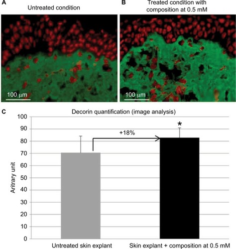Figure 5 Visualization of core protein decorin expression in skin explants treated (B) with or (A) without cosmetic composition at 0.5 mM for 8 days and maintained in survival.