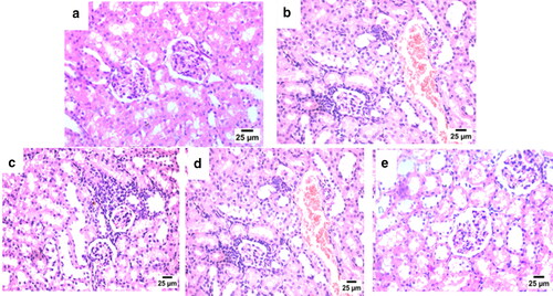 Figure 9. Histological H&E stained sections of Kidney (a–e) (×200) (b,d) (×100). (a) Control model, (b) Diabetic model, (c) Diabetic model + developed drug, (d) Diabetic model + Marketed product, and (e) Diabetic mode with Canagliflozin nanocrystals.