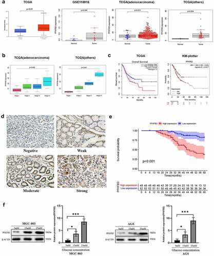 Figure 1. PFKFB3 overexpression was correlated with poor prognosis and its expression could be enhanced by hyperglycemia in GC. (a, b, c) PFKFB3 expression was significantly upregulated and its overexpression was correlated with clinical stage and the poor prognosis of GC patients based on online databases; (d) Representative IHC images with different PFKFB3 expression in GC tissues(×200 magnification); (e) PFKFB3 expression was significantly related to the overall survival of GC patients based on clinical samples; (f) Hyperglycemia could stimulate PFKFB3 overexpression in GC cells. *P < 0.05, **P < 0.01, ***P < 0.001