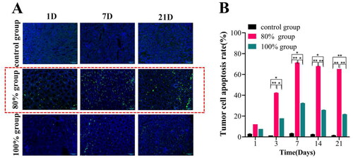 Figure 4. Tumor cell apoptosis was observed by TUNEL staining in each group after HIFU ablation in different range. (A) Observation of TUNEL fluorescence staining under confocal laser microscopy; (B) Fluorescence intensity analysis of TUNEL expression in each group at different time points after HIFU ablation (n = 5, *p < 0.05, **p < 0.001, scale bar = 100 μm).