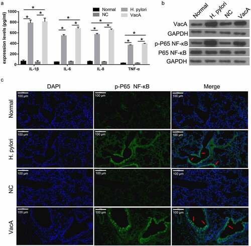 Figure 2. Effect of H. pylori infection and VacA treatment on the expression of inflammatory factors and NF-κB signaling in mice. (a) Levels of TNF-α, IL-1β, IL-6, and IL-8 in mouse blood samples after H. pylori infection and VacA treatment were measured by ELISA. (b) VacA, p-p65 NF-κB, and p65 NF-κB protein expression in mouse lung tissue after H. pylori infection and VacA treatment was analyzed by Western blotting. (c) p-p65 NF-κB protein expression in mouse lung tissue after H. pylori infection and VacA treatment was measured by immunofluorescence assay. Red arrows indicate the translocation of p65 NF-κB to the nucleus. (*P < 0.05).