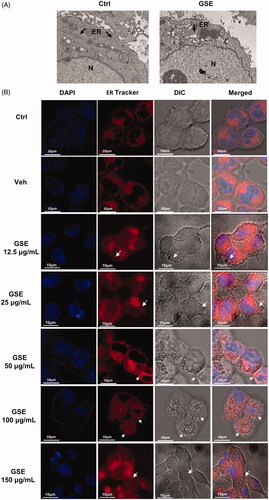 Figure 3. GSE induces cytoplasmic vacuolation originating from the endoplasmic reticulum (ER) in HepG2 cells. (A) Swelling of the ER in HepG2 cells after treatment with 100 μg/mL of GSE for 24 h. Cells were visualized via transmission electron microscopy. Arrowheads indicate the ER. (B) Cytoplasmic vacuolation in HepG2 cells resulting from enlargement of the ER. HepG2 cells were incubated with ER-Tracker Red dye (1 μM) after exposure to GSE for 24 h and were observed via a fluorescence microscope (scale bars, 10 μm). Ctrl: control; Veh: vehicle; N: nuclear: ER: endoplasmic reticulum; DIC: differential interference contrast.