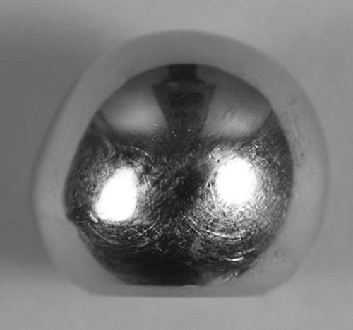 Figure 2. The removed cobalt-chromium head showing loss of the superior part of the head because of severe wear.