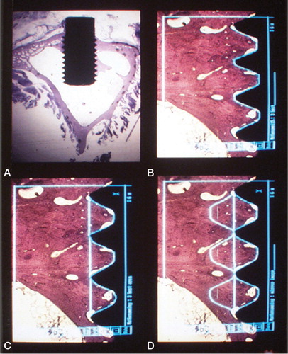 Figure 22. Illustration of the histomorphometric evaluation. A) Screw in situ in the cortical region of the rabbit tibia. B) Bone-implant contact. C) Bone area within the threads. D) Outfolded mirror image.