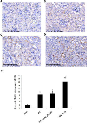 Figure 3 Evaluation of CD31-labelled microvessel density in kidneys. (A–D) CD31-labelled microvessels in kidney from various groups, original magnification, ×400. (A) Sham groups. (B) IRI groups. (C) IRI+empty plasmid groups. (D) IRI+IMD groups. Each positive area was calculated as one microvessel. (E) Scores of CD31+ MVD levels. The results are expressed as the mean ± SD (n = 20 in each group). *P < 0.05 vs sham group; #P < 0.05 vs IRI group.