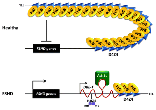 Figure 2. Model of DBE-T mediated de-repression of 4q35 genes in FSHD. In healthy subjects, the D4Z4 repeat array carrying many units displays extensive binding of PcG proteins leading to repression of the 4q35 locus. In FSHD patients, reduction in D4Z4 copy number critically diminishes PcG binding and silencing, allowing for transcription of the lncRNA DBE-T to occur. DBE-T functions in cis to promote opening of chromatin structure and de-repression of 4q35 genes through direct binding and recruitment of the TrxG protein Ash1L, which drives H3K36me2 at the FSHD locus.