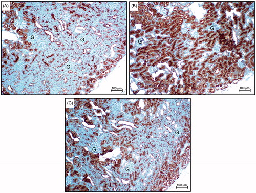 Figure 2. Immunostaining of the iNOS protein in the kidneys revealed intense positive staining (brown) in the tubular structure of kidneys subjected to SWT procedure (B). Immunostaining for iNOS was lower in the SWT+1400W group (C) when compared with the SWT group. Figure A shows the control group.