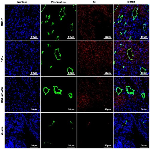 Figure 8 Distribution of PTX-AMD070 NBs in tissues. Distribution of PTX-AMD070 NBs in MCF-7 xenografts (upper panel), in C33a xenografts (middle and upper panel), in MDA-MB-468 xenografts (middle and lower panel), and in thigh muscle tissue (lower panel). The nuclei are stained blue; the tumor blood vessels are shown in green; the DiI-labeled PTX-AMD070 NBs are red.