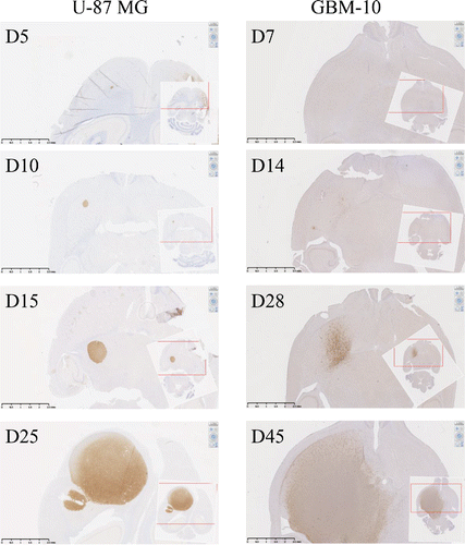 Figure 4. In vivo development of orthotopic human-GBM brain model in NSG mice. Human-MHC class I expression was analyzed by IHC on NSG mouse brain sections performed at days 5, 10, 15 and 25 after U-87MG brain implantation (left pictures) or at days 7, 14, 28 and 45 after GBM-10 implantation (right pictures).