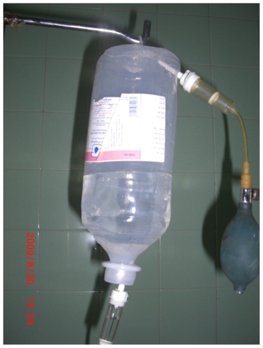 Figure 2 Pump and bulb connected to normal saline bag.