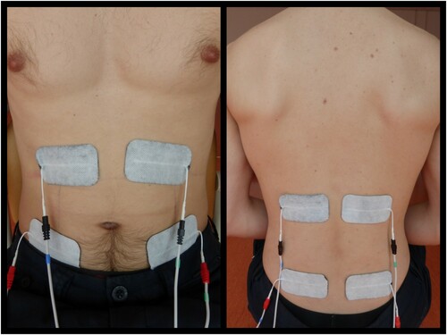 Figure 1 Electrode placement on the rectus abdominis muscle, obliquus externus abdominis muscle (left) and erector spinae muscle (right).