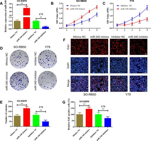 Figure 3 miR-340 promoted retinoblastoma cell proliferation in vitro. (A) miR-340 expression level was determined using qRT-PCR in WERI-RB1and Y79 cells after transfection with miR-340 mimics or miR-340 inhibitor. (B and C) CCK-8 assay results showed that miR-340 mimics promoted SO-RB50 cells proliferation (B), while miR-340 inhibitor suppressed Y79 cells proliferation (C) compared with negative control. (D and E) Colony formation assay results showed that miR-340 overexpression increased the number of colonies in SO-RB50 cells (D), but miR-340 knockdown decreased the number of colonies in Y79 cells (E) compared with negative control. (F and G) EdU incorporation assay demonstrated that up-regulation of miR-340 dramatically enhanced the percentage of EdU-positive cells in SO-RB50 cells (F) and down-regulation of miR-340 reduced the percentage of EdU-positive cells in Y79 cells (G) with negative control. *P<0.05, **P<0.01. Scale bars, 100 μm.