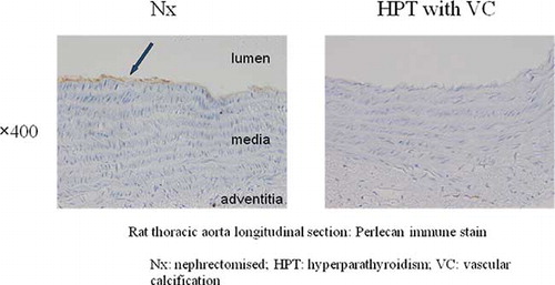 Figure 3.  Immunohistochemical examination using anti-perlecan antibodies showed positive staining in the basement membrane (arrow) under endothelial cells in the Nx aorta, whereas no positive staining was seen in the HPT aorta. Abbreviations: Nx  =  nephrectomized, HPT = hyperparathyroidism, VC  =  vascular calcification.