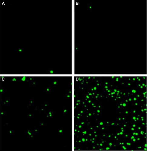 Figure 7 TUNEL assay.Notes: Tumor tissue sections of NS-treated group (A), EM-treated group (B), free-Qu-treated group (C), and Qu-M-treated group (D) were stained with TUNEL for the cell apoptosis assay. The results indicate that inducing apoptosis may be one of the antitumor mechanisms of Qu-M and free-Qu in vivo.Abbreviations: NS, normal saline; EM, empty MPEG–PCL nanomicelles; MPEG–PCL, monomethoxy poly(ethylene glycol)–poly(ε-caprolactone); free-Qu, free quercetin; Qu-M, quercetin-loaded MPEG–PCL nanomicelles.