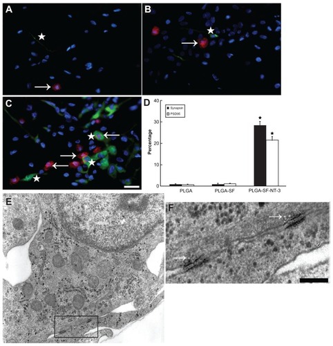 Figure 5 Synaptic formation of culture cells in the NT-3-PLGA carriers. Cells were immunostained with antibodies against pre- and postsynaptic markers (PSD95 versus synapsin). Nuclei were labeled by DAPI (blue). (A) Only a few cells expressed synapsin (stars in A–C = green) and PSD95 (arrows in A–C = red) in the PLGA group. PSD95 was localized in the cell body; whereas synapsin was expressed in both the cell body and neurite; (B) Synapsin- or PSD95-positive cells were sparse in the PLGA-SF group; (C) In the PLGA-SF-NT3 group, the cells expressed (1) cells positive for either PSD95 or synapsin; (2) cells positive for both PSD95 and synapsin; (3) cells with positive PSD95-staining in the body, but receiving synapsin-positive neurites extending from another cell; (D) Cells with staining of PSD95 and synapsin were manually counted. Compared with other groups, positively stained cells (Synapsin+ or PSD95+) in the PLGA-SF-NT3 group were significantly higher than any other groups (P < 0.05; the star in D indicates P < 0.05 when PLGA-SF-NT-3 versus PLGA or PLGA-SF); (E) Under transmission electron microscopy (TEM), a neuron was identified in PLGA-SF-NT-3 group. Note the neurite extending from the soma of one cell and connecting to a neutrite of another cell. (F) High magnification TEM of synapse formation in cultured cells, revealing specialized high-density pre- and postsynaptic membrane, synaptic cleft, and vesicles in its terminal.Note: Scale bar = 20 μm in A–C, 200 nm in F.Abbreviations: NT-3, neurotrophin-3; PLGA, poly-(lactic acid-co-glycolic acid); PSD95, postsynaptic density-95; DAPI, 4′,6-diamidino-2-phenylindole; SF, silk fibroin.