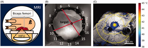 Figure 1. Experimental setup. (A) The animal is positioned on the HIFU table such that the biceps femoris can be sonicated. (B) The rubber tube containing fish oil capsules is visible in MRI and is used to document the target site. (C) MRI with temperature map overlay. Yellow contour: Drift correction ROI with manually excluded areas. Red contour: Target ROI.