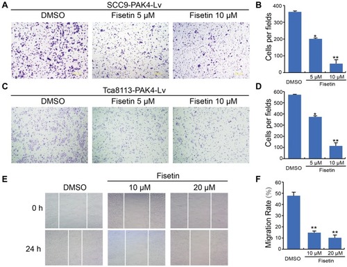 Figure 4 Fisetin inhibits the migration of PAK4-overexpressing OSCC cells.