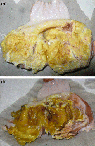 Figure 1.  Gizzards of (1a) 19-day-old and (1b) 14-day-old broilers with erosions in the koilin layer and inflammation of the mucosa.