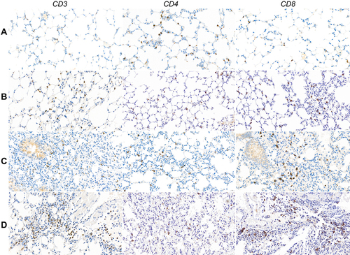 Figure 6 Immunohistochemistry of lymphocyte infiltration in lung tissue 1 month after irradiation and/or anti-PD-1 treatment in each group. (A) Control; (B) PD-1 inhibitor alone; (C) irradiation alone; (D) PD-1 inhibitor + irradiation.