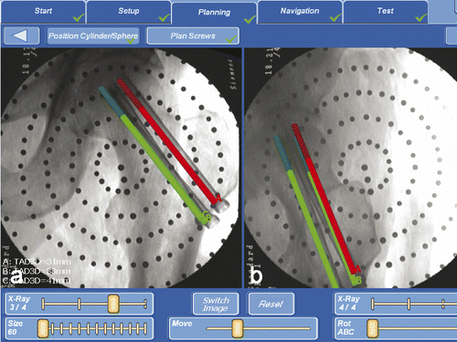 Figure 8. Screenshot of the final implant position in the frontal (a) and lateral (b) views.
