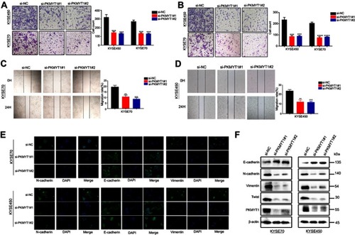 Figure 4 Down-regulated PKMYT1 in ESCC cells inhibits the migration and invasion abilities of ESCC cells. (A) Transwell migration assays indicated that the migration abilities of KYSE70 and KYSE450 cells were weakened in siRNA groups. (B) Invasion assays showed silencing PKMYT1 inhibited the invasion ability.(C, D) Wound healing assay showed that inhibited the expression of PKMYT1 induced weaken migration ability (E) Western blot showed the change of EMT-related biomarkers. The expression of E-CAD was increased in siRNA groups while the decreased expression of NCAD, VIM, and TWIST. (F) Immunofluorescence showed that after transfection, increased expression of ECAD and decreased expression of NCAD and VIM in siRNA groups than NC group, which meant down-regulated the expression of PKMYT1 inhibited EMT progression in ESCC cells. **P<0.01, *** P<0.001,****P<0.0001.Abbreviations: PKMYT1, protein kinase, membrane associated tyrosine/threonine; ESCC, esophageal squamous cell carcinoma; ECAD, E-Cadherin; NCAD, N-Cadherin; VIM, vimentin.