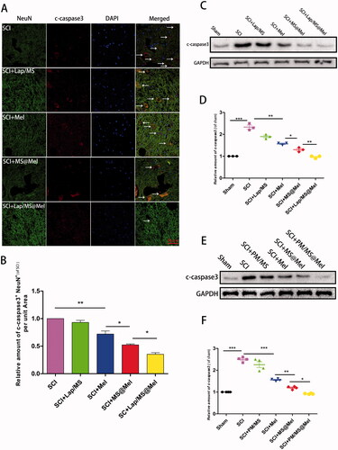 Figure 5. (A,B) Immunofluorescence and intensity co-staining of NeuN (green) and c-caspase3 (red) of the respective groups.(C-F) The protein expression and densitometric quantification of c-caspase3 across the respective groups (n = 5 per group).