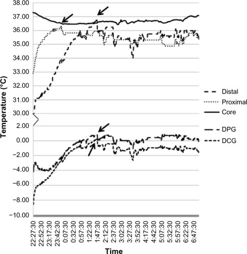 Figure 1 Temperature changes during sleep for one participant from bedtime to wake time.