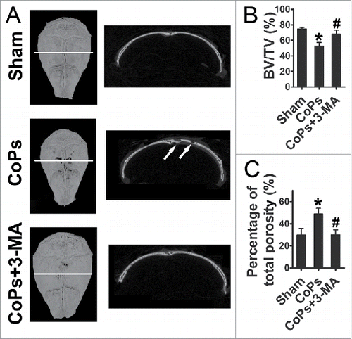 Figure 6. The autophagy inhibitor 3-MA ameliorates CoPs-induced mouse calvarial osteolysis assessed by micro-CT. (A) Representative images of micro-CT with 3-dimensional reconstructed images from each group (left). Cross-sectional views of the reconstructed images were indicated by the white horizontal line in the left panel, and the bone osteolysis sites are indicated by white arrows (right). (B) BV/TV and percentage of total porosity of each sample were measured. Values are expressed as means ± S.E.M. n = 7 mice per group. *, P < 0.05, vs. sham; #, P < 0.05 vs. CoPs group.