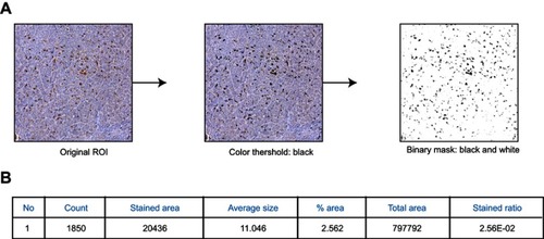 Figure S2 Calculation of myeloid cell infiltration in tumor tissue. The displayed photomicrograph slide was digitalized and randomly selected frames were imported to ImageJ software. Subsequently, black threshold was created over original frame and a binary mask was created to visualize black spots on white background (A). Quantification of shown example displays stained pixelated area, total pixelated area, pixel size and pixel count. The ratio of the stained area pixel to the total area pixel is called the stained pixel ratio and is shown on the y-axes in Figures 6 and S6 (B)