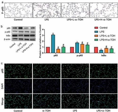 Figure 4. α-TOH inhibits NF-κB signaling pathway in alveolar epithelial cells in vivo and in vitro. (a) IHC staining results of p-p65 in mice lung (400×); (b) Western blot results of p65, p-p65, and IκBα; (c) IF staining results of p65 in MLE-12 cells.