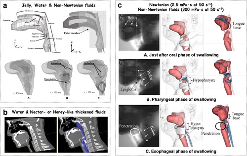 Figure 7. In-silico simulation equipment: (a) finite element model (FEM) of fluid simulation with euler meshes; (b) smoothed particle hydrodynamics (SPH) with a dynamic mesh as the fluid boundary condition. The bolus is grey and streaky, and the air is dark; (c) Hamiltonian moving particle semi-implicit (HMPS) method. The simulation of swallowed non-Newtonian fluids in patients with mild dysphagia appeared to be penetrating and corresponded well to the VFSS images.(a) is adapted from Ref. (Sonomura et al. Citation2011) with permission from John Wiley & Sons, Copyright 2011. (b) is reprinted from Ref. (Ho et al. Citation2017) with permission from Elsevier, Copyright 2017. (c) is adapted from Ref. (Michiwaki et al. Citation2020) with permission from Elsevier, Copyright 2020.