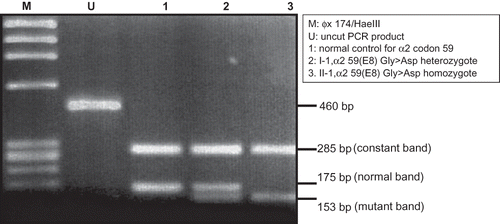 FIGURE 2 Gel electrophoresis of the PCR-RFLP products from Family 1.