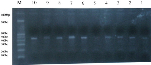 Figure 1.  Electrophoresis result of Prothrombin gene G20210 DNA amplification fragment in TJR patients. M: DNA Marker 1–10 patients number.